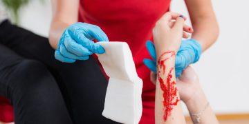 Bleeding Control: Principles, Techniques, and Modern Practices in Hemorrhage Management