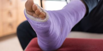 Management of Fractures and Sprains: Comprehensive Approaches in Emergency and Clinical Care