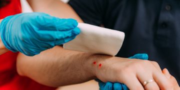 Snake Bites and Wildlife Injuries: Wilderness First Aid and Treatment